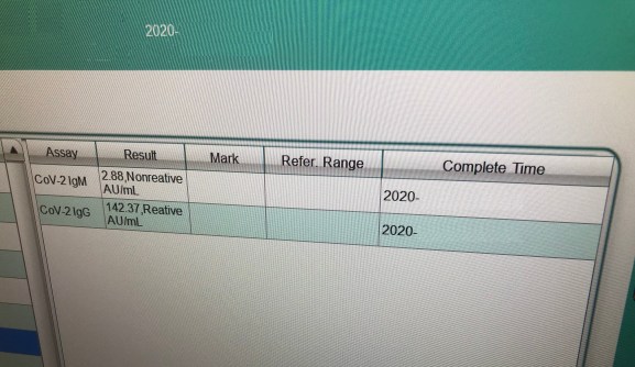 Corona_antibody_test